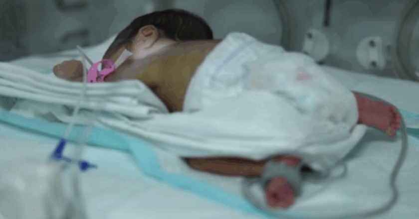 Türkiye’de 100 bebekten 13’ü prematüre dünyaya geliyor